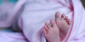 مصر میں ایک ایسا بچہ پیدا ہوا ہے جس کے 4 گردے ہیں، رپورٹ