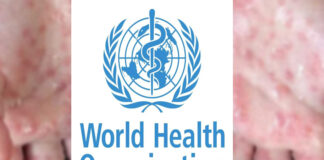 عالمی ادارہ صحت نے منکی پاکس کے عالمی پھیلا ئوکے خدشے سے خبردار کر دیا