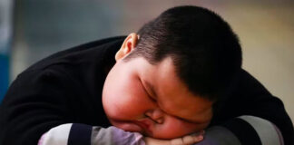 بچپن میں موٹاپے کا شکار افراد کے ڈیمینشیا میں مبتلا ہونے کے خطرات بڑھ جاتے ہیں، تحقیق