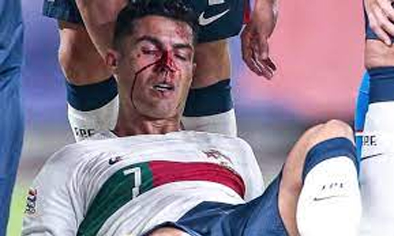 رونالڈو یوئیفا نیشنز لیگ کے میچ میں کھلاڑی سے ٹکرانے کے بعد بری طرح زخمی